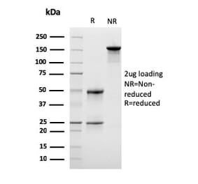 SDS-PAGE - Anti-LSP1 Antibody [LSP1/3042] (A249238) - Antibodies.com