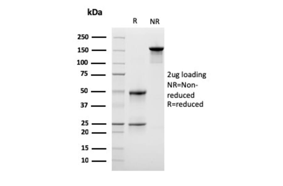 SDS-PAGE - Anti-LSP1 Antibody [LSP1/3042] (A249238) - Antibodies.com