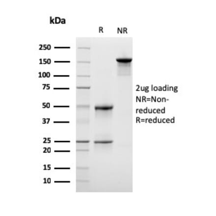 SDS-PAGE - Anti-LSP1 Antibody [LSP1/3042] (A249238) - Antibodies.com