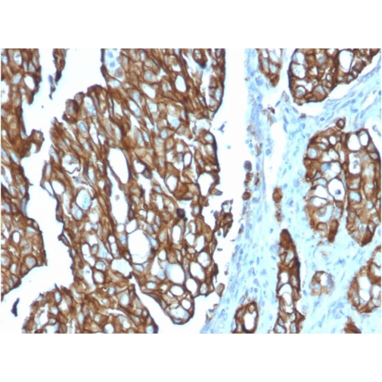 Immunohistochemistry - Anti-TROP2 Antibody [TACSTD2/2151] (A249239) - Antibodies.com