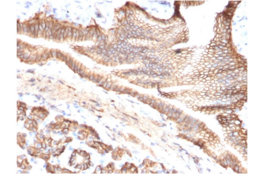 Immunohistochemistry - Anti-TROP2 Antibody [TACSTD2/2151] (A249239) - Antibodies.com