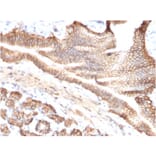 Immunohistochemistry - Anti-TROP2 Antibody [TACSTD2/2151] (A249239) - Antibodies.com