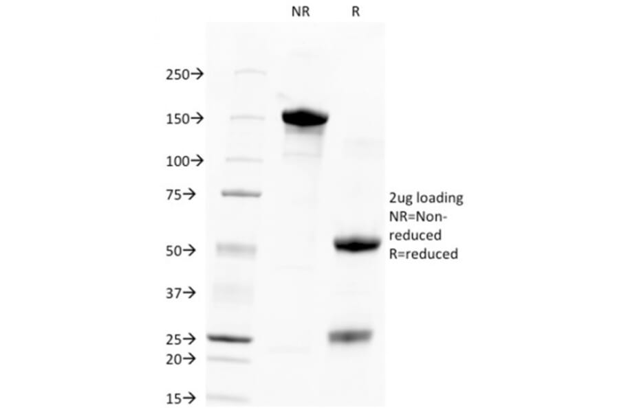 SDS-PAGE - Anti-TROP2 Antibody [TACSTD2/2151] (A249239) - Antibodies.com