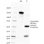 SDS-PAGE - Anti-TROP2 Antibody [TACSTD2/2151] (A249239) - Antibodies.com