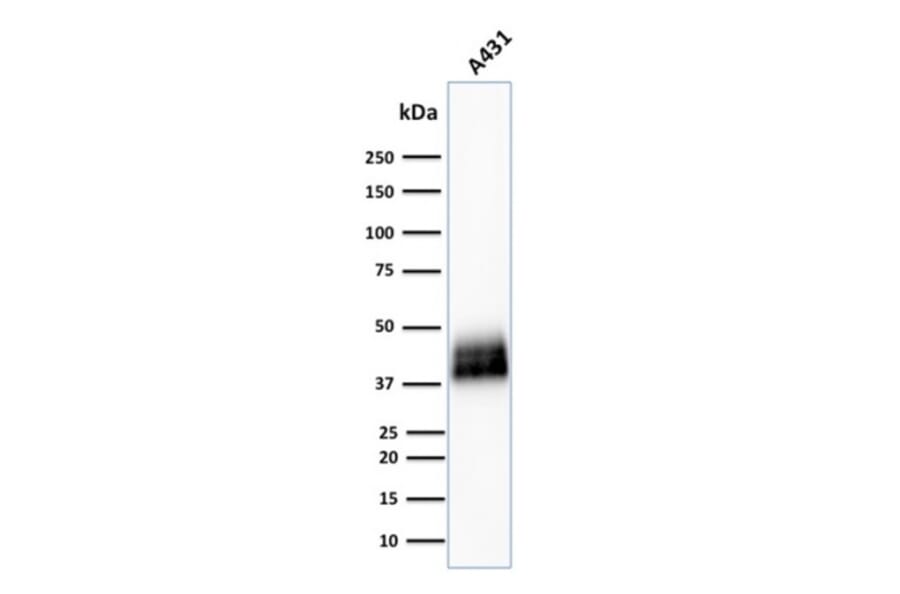 Western Blot - Anti-TROP2 Antibody [TACSTD2/2151] (A249239) - Antibodies.com