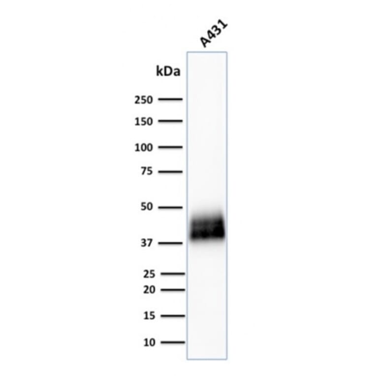 Western Blot - Anti-TROP2 Antibody [TACSTD2/2151] (A249239) - Antibodies.com