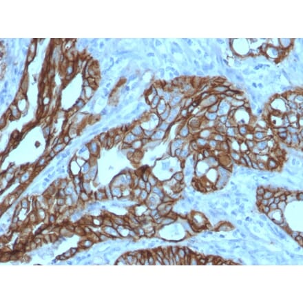 Immunohistochemistry - Anti-TROP2 Antibody [TACSTD2/2152] (A249240) - Antibodies.com