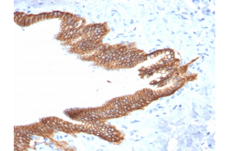 Immunohistochemistry - Anti-TROP2 Antibody [TACSTD2/2152] (A249240) - Antibodies.com