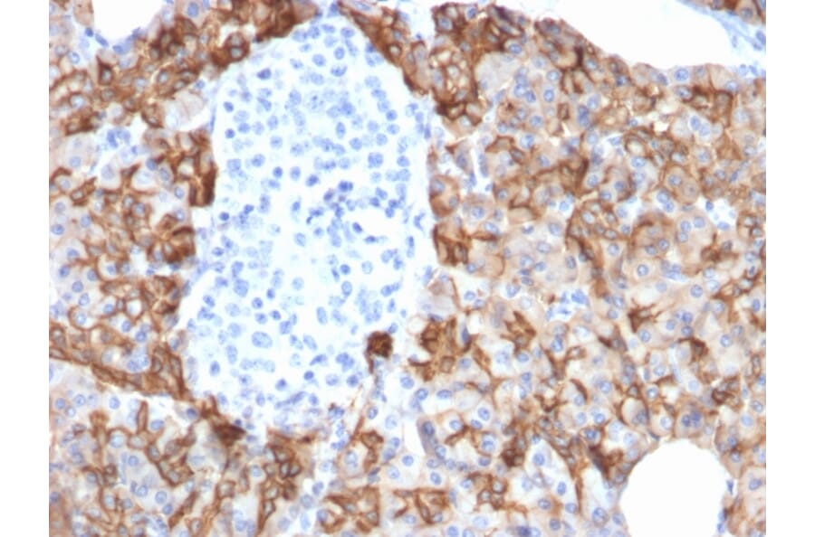 Immunohistochemistry - Anti-TROP2 Antibody [TACSTD2/2152] (A249240) - Antibodies.com