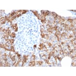 Immunohistochemistry - Anti-TROP2 Antibody [TACSTD2/2152] (A249240) - Antibodies.com