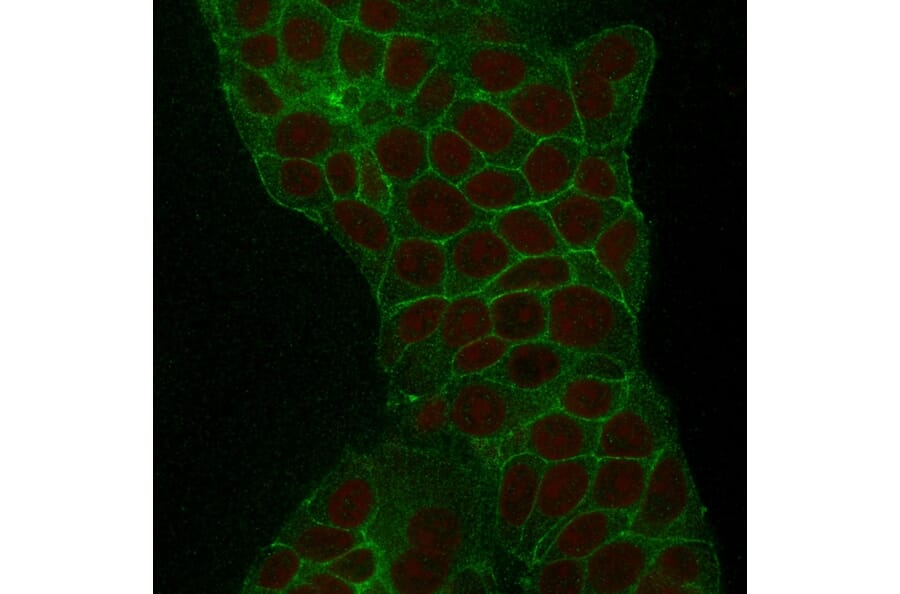 Immunofluorescence - Anti-TROP2 Antibody [TACSTD2/2152] (A249240) - Antibodies.com
