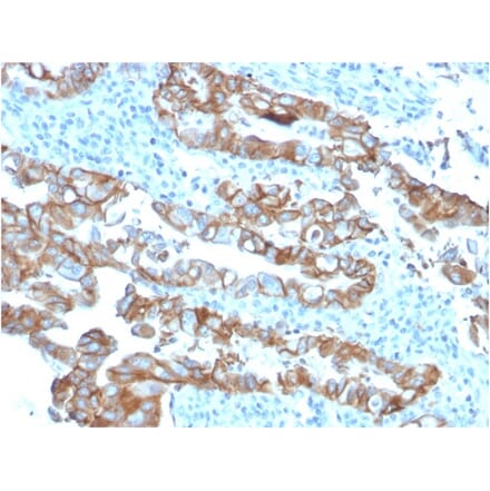 Immunohistochemistry - Anti-TROP2 Antibody [TACSTD2/2153] (A249241) - Antibodies.com