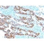Immunohistochemistry - Anti-TROP2 Antibody [TACSTD2/2153] (A249241) - Antibodies.com