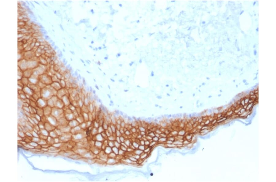 Immunohistochemistry - Anti-TROP2 Antibody [TACSTD2/2153] (A249241) - Antibodies.com