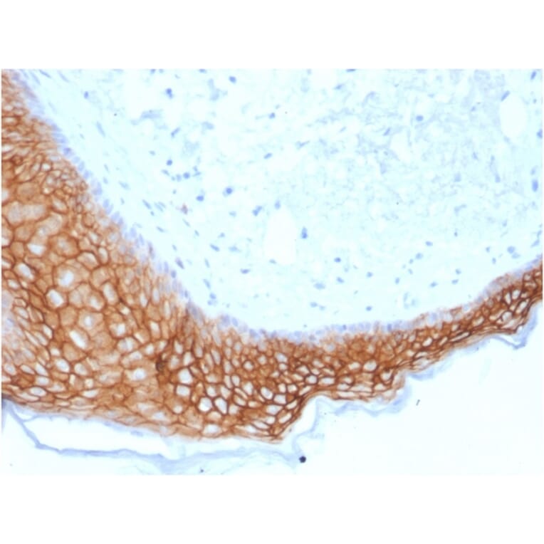 Immunohistochemistry - Anti-TROP2 Antibody [TACSTD2/2153] (A249241) - Antibodies.com