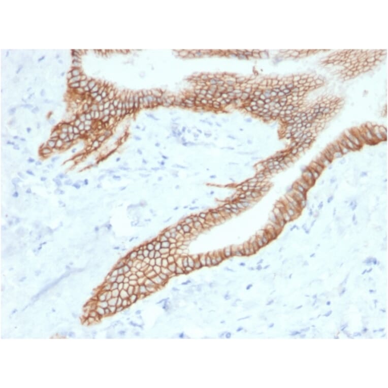Immunohistochemistry - Anti-TROP2 Antibody [TACSTD2/2153] (A249241) - Antibodies.com