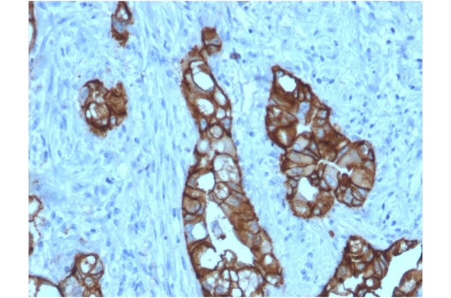 Immunohistochemistry - Anti-TROP2 Antibody [rTACSTD2/6397] (A249242) - Antibodies.com