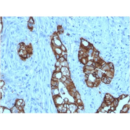 Immunohistochemistry - Anti-TROP2 Antibody [rTACSTD2/6397] (A249242) - Antibodies.com