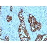 Immunohistochemistry - Anti-TROP2 Antibody [rTACSTD2/6397] (A249242) - Antibodies.com