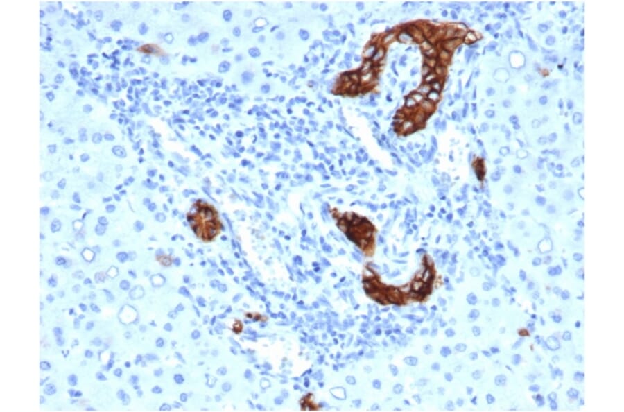Immunohistochemistry - Anti-TROP2 Antibody [rTACSTD2/6397] (A249241) - Antibodies.com