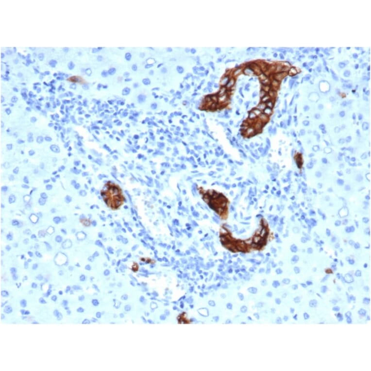 Immunohistochemistry - Anti-TROP2 Antibody [rTACSTD2/6397] (A249241) - Antibodies.com