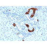 Immunohistochemistry - Anti-TROP2 Antibody [rTACSTD2/6397] (A249241) - Antibodies.com