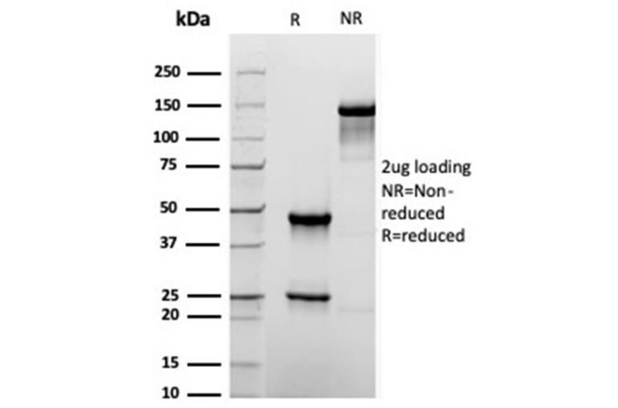 SDS-PAGE - Anti-TROP2 Antibody [rTACSTD2/6397] (A249242) - Antibodies.com