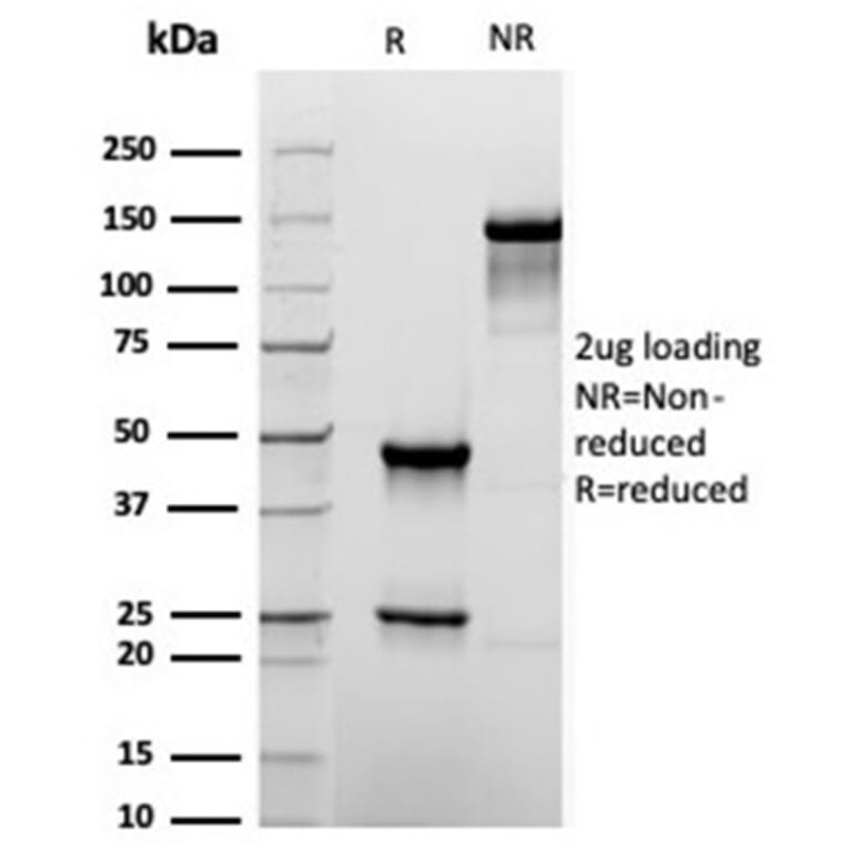 SDS-PAGE - Anti-TROP2 Antibody [rTACSTD2/6397] (A249242) - Antibodies.com