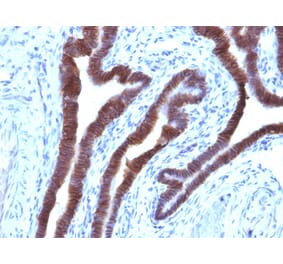 Immunohistochemistry - Anti-EpCAM Antibody [EGP40/1110] (A249243) - Antibodies.com