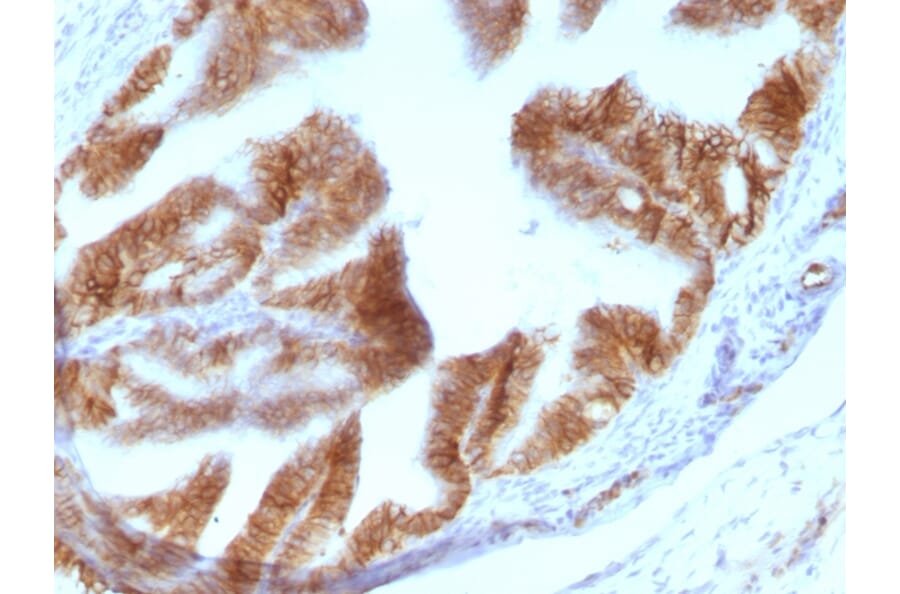 Immunohistochemistry - Anti-EpCAM Antibody [EGP40/1110] (A249243) - Antibodies.com