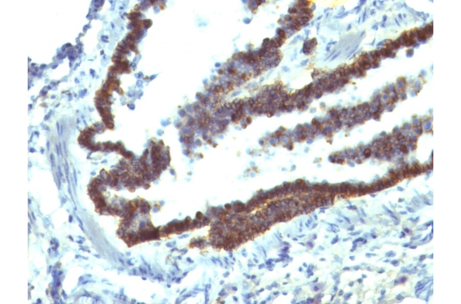 Immunohistochemistry - Anti-EpCAM Antibody [EGP40/1110] (A249243) - Antibodies.com