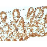 Immunohistochemistry - Anti-EpCAM Antibody [EGP40/1110] (A249243) - Antibodies.com