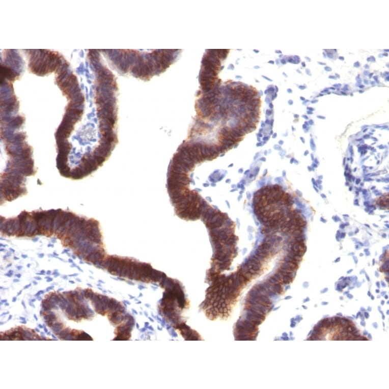 Immunohistochemistry - Anti-EpCAM Antibody [EGP40/1120] (A249243) - Antibodies.com