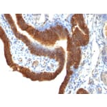 Immunohistochemistry - Anti-EpCAM Antibody [SPM491] (A249244) - Antibodies.com