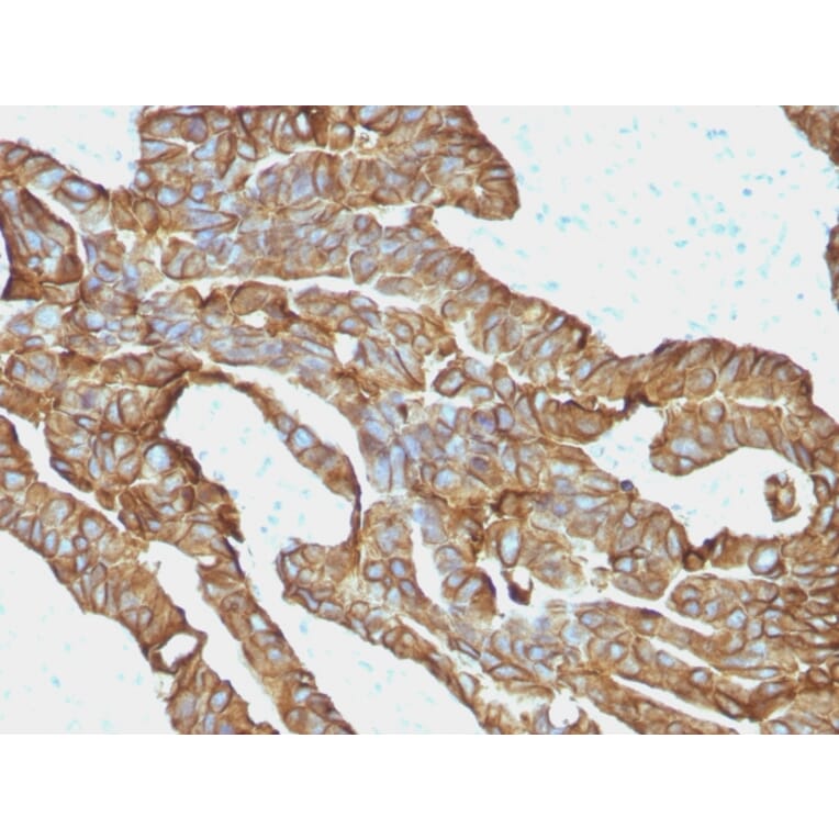 Immunohistochemistry - Anti-EpCAM Antibody [EGP40/1372] (A249246) - Antibodies.com
