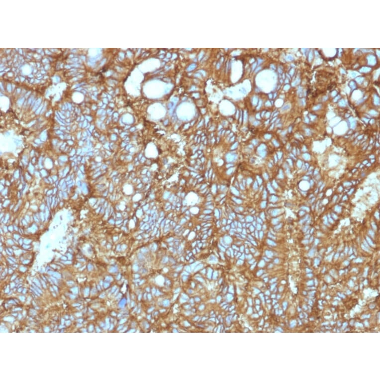 Immunohistochemistry - Anti-EpCAM Antibody [EGP40/1372] (A249246) - Antibodies.com