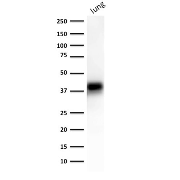 Western Blot - Anti-EpCAM Antibody [EGP40/1372] (A249246) - Antibodies.com