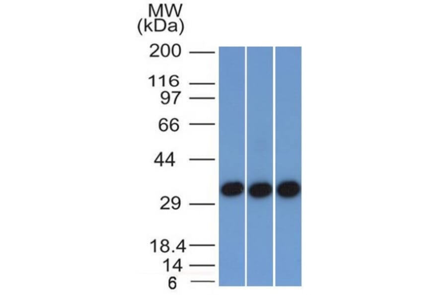 Western Blot - Anti-EpCAM Antibody [EGP40/1372] (A249246) - Antibodies.com