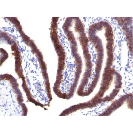 Immunohistochemistry - Anti-EpCAM Antibody [EGP40/1373] (A249247) - Antibodies.com