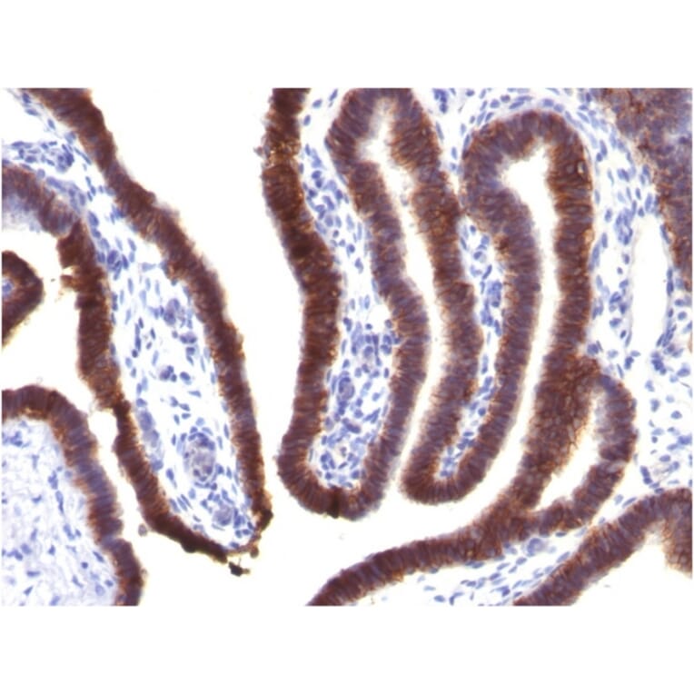 Immunohistochemistry - Anti-EpCAM Antibody [EGP40/1373] (A249247) - Antibodies.com