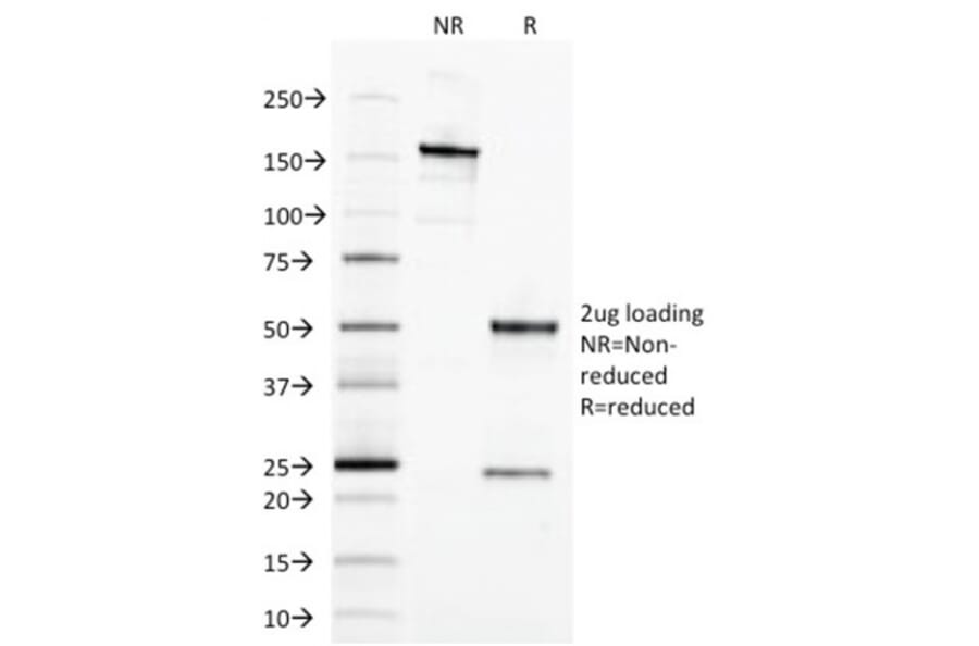 SDS-PAGE - Anti-EpCAM Antibody [EGP40/1373] (A249247) - Antibodies.com