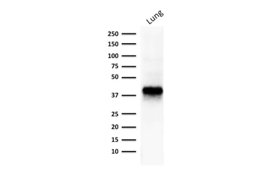 Western Blot - Anti-EpCAM Antibody [EGP40/1373] (A249247) - Antibodies.com