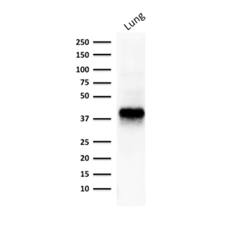 Western Blot - Anti-EpCAM Antibody [EGP40/1373] (A249247) - Antibodies.com