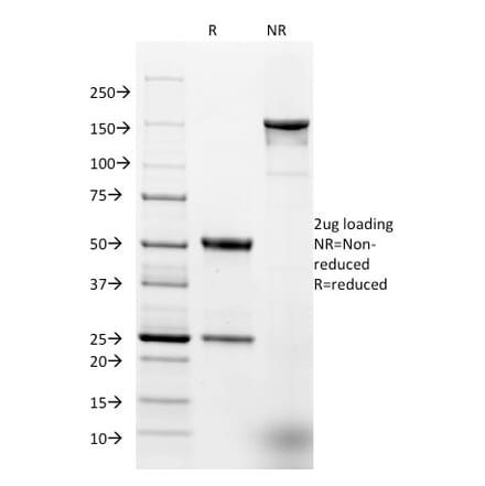 SDS-PAGE - Anti-EpCAM Antibody [EGP40/1384] (A249248) - Antibodies.com