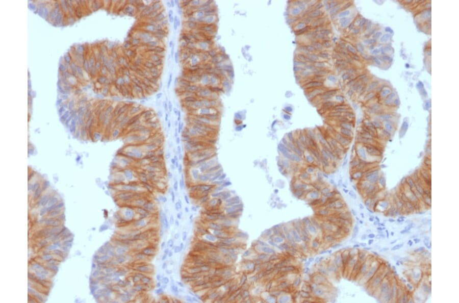 Immunohistochemistry - Anti-EpCAM Antibody [EGP40/1384] (A249248) - Antibodies.com