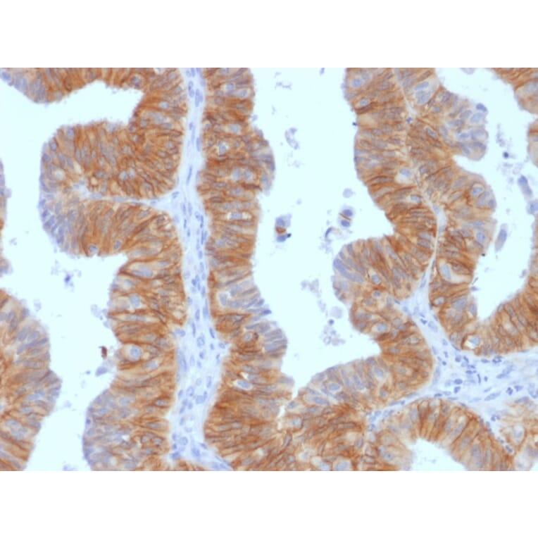 Immunohistochemistry - Anti-EpCAM Antibody [EGP40/1384] (A249248) - Antibodies.com