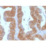 Immunohistochemistry - Anti-EpCAM Antibody [EGP40/1384] (A249248) - Antibodies.com