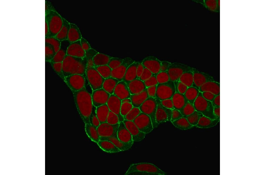 Immunofluorescence - Anti-EpCAM Antibody [EGP40/1384] (A249248) - Antibodies.com