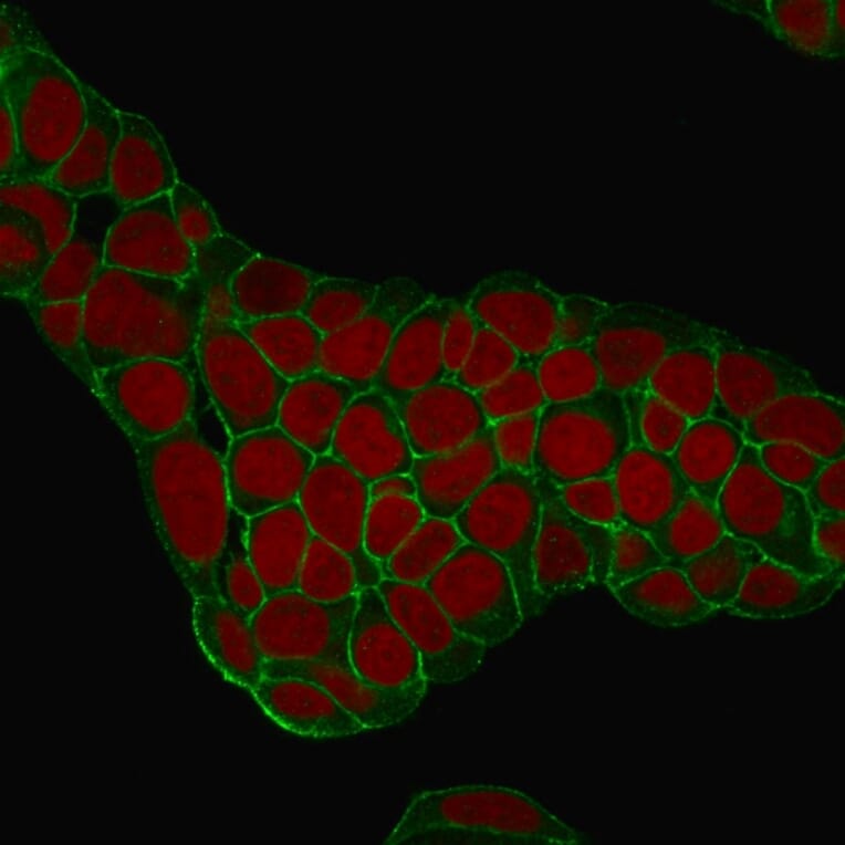 Immunofluorescence - Anti-EpCAM Antibody [EGP40/1384] (A249248) - Antibodies.com