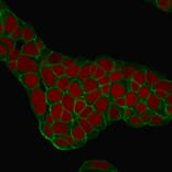 Immunofluorescence - Anti-EpCAM Antibody [EGP40/1384] (A249248) - Antibodies.com